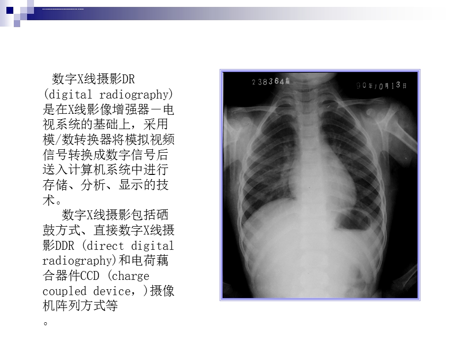 医学影像处理图像处理ppt课件.ppt_第3页