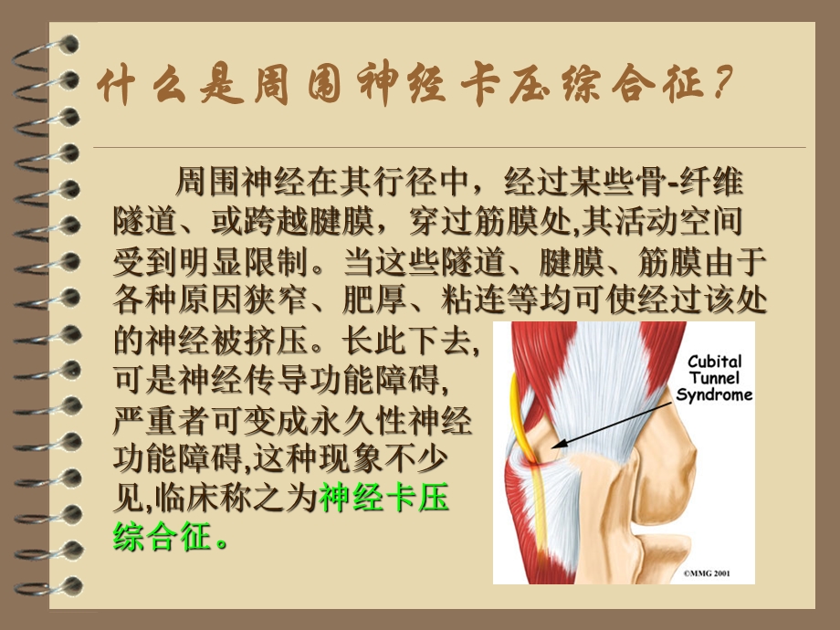 周围神经卡压ppt课件.ppt_第2页