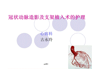 冠脉造影及支架植入术的护理ppt课件.ppt