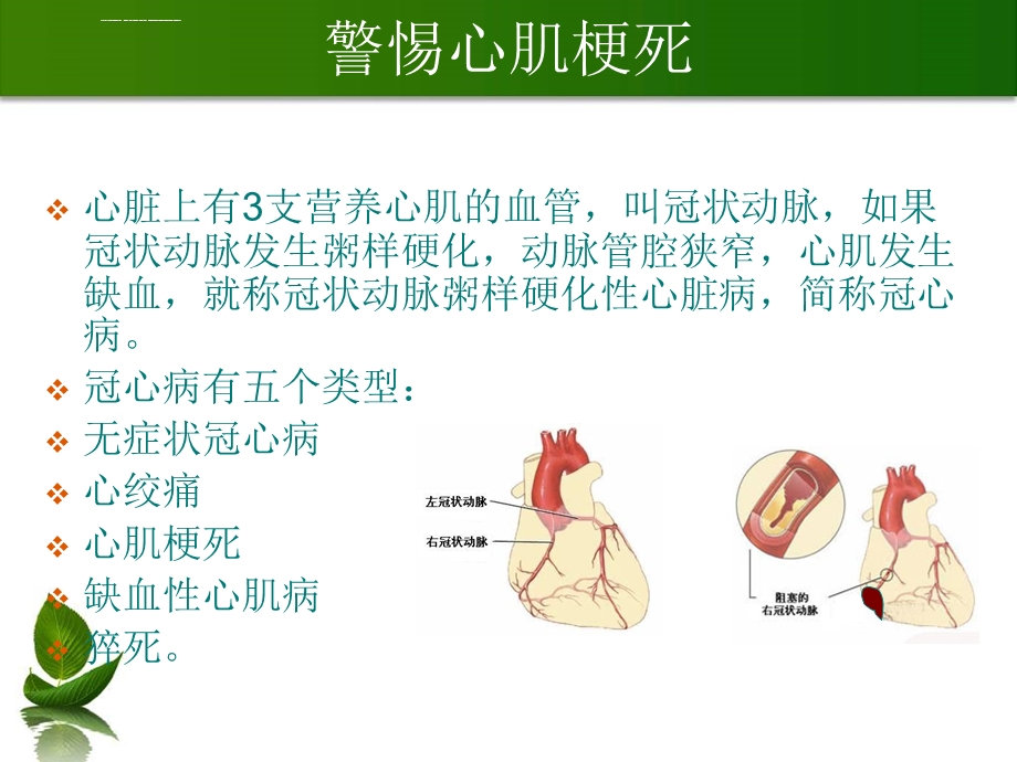 冬季中老年人常见病防治及保健ppt课件.ppt_第3页