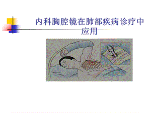 内科胸腔镜ppt课件.ppt