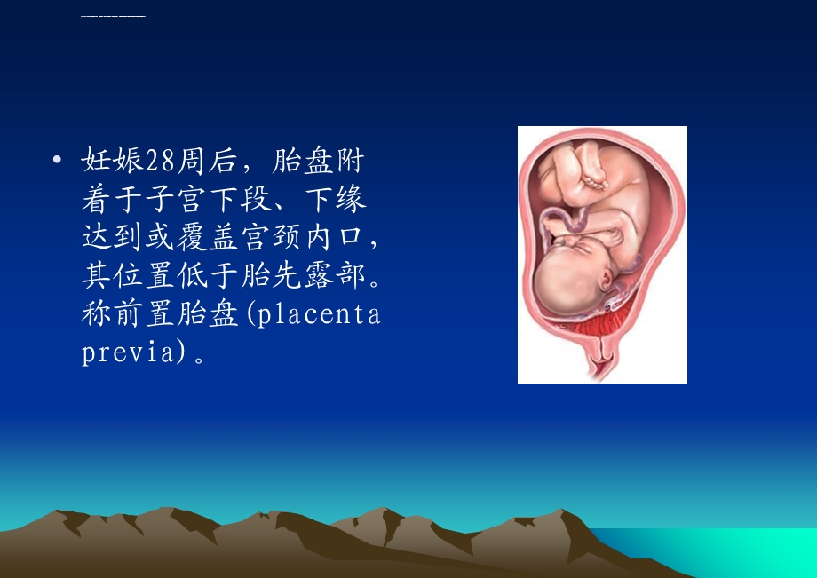 前置胎盘教学查房ppt课件.ppt_第2页