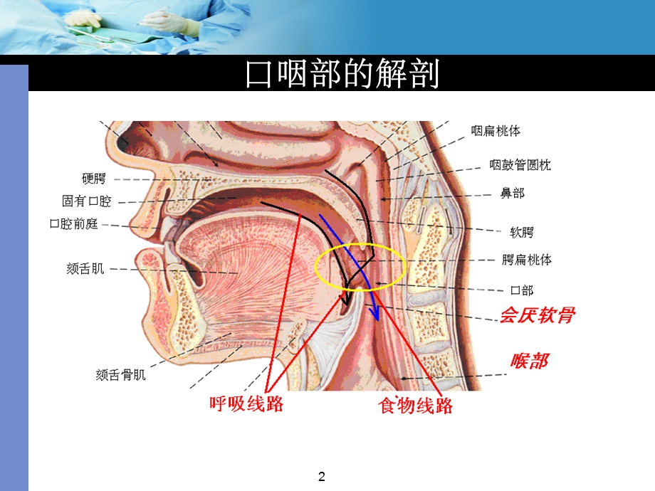 口咽通气道的使用ppt课件.ppt_第2页