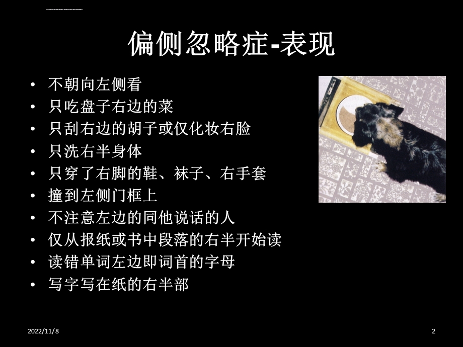 单侧忽略的概述、评定与治疗ppt课件.ppt_第2页