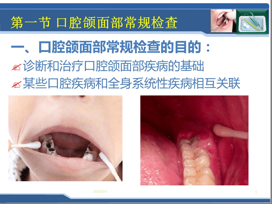 口腔科学口腔颌面部检查参考幻灯片ppt课件.ppt_第3页