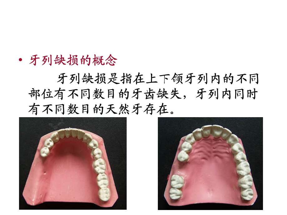 口腔修复学ppt课件.ppt_第3页