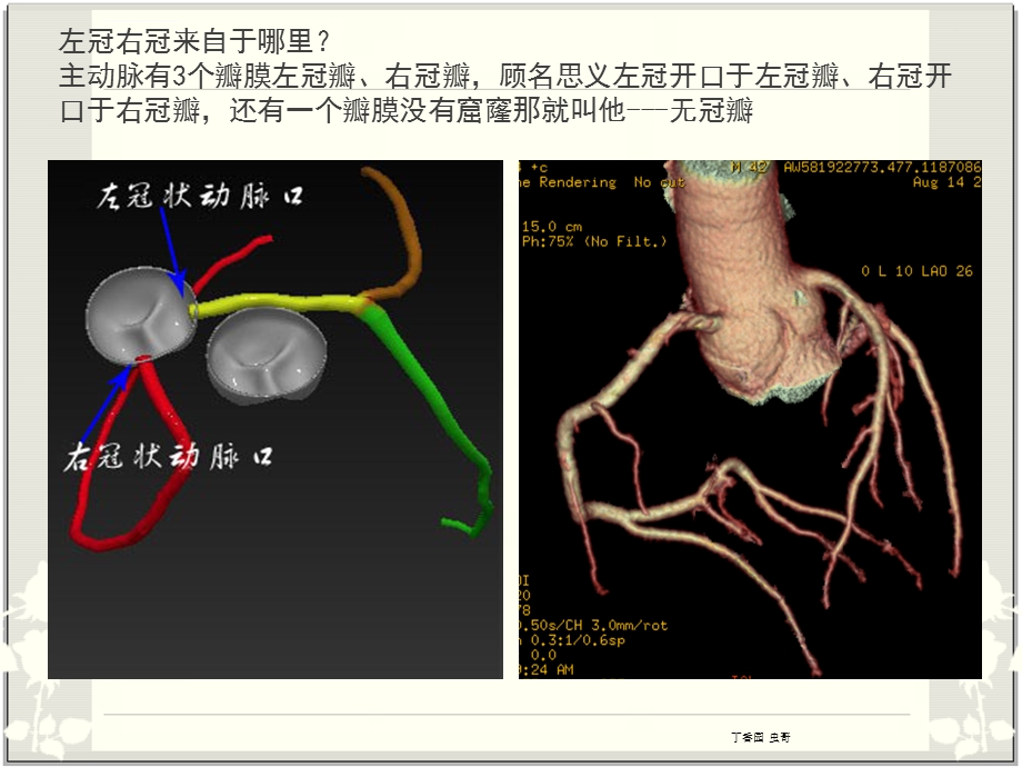 冠脉解剖与CTA(最简单最容易记忆图片最丰富)ppt课件.ppt_第3页