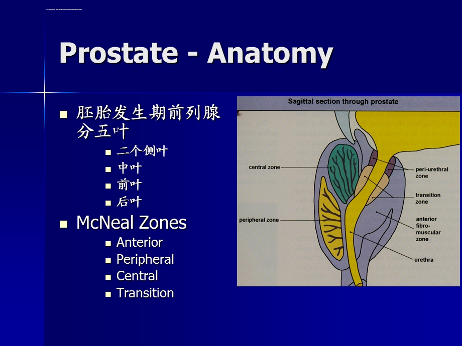 前列腺癌的病理分级ppt课件.ppt_第3页