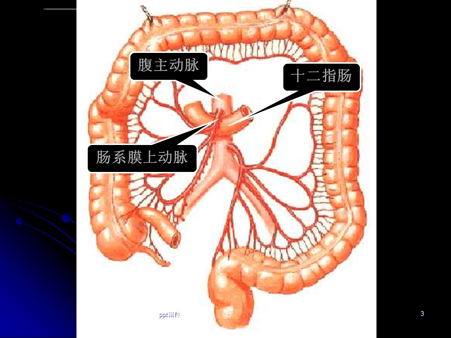 十二指肠淤积症ppt课件.ppt_第3页