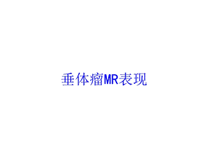 垂体瘤MR表现培训课件.ppt