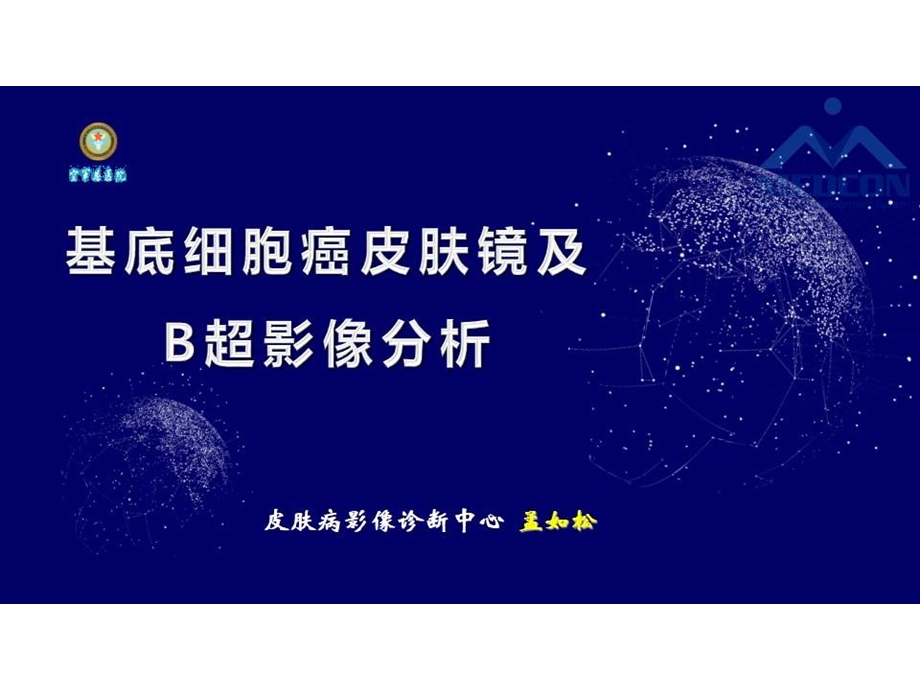 基底细胞癌皮肤镜及B超影像分析ppt课件.pptx_第2页