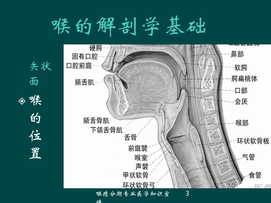 喉癌分期专业医学知识宣讲培训课件.ppt_第3页