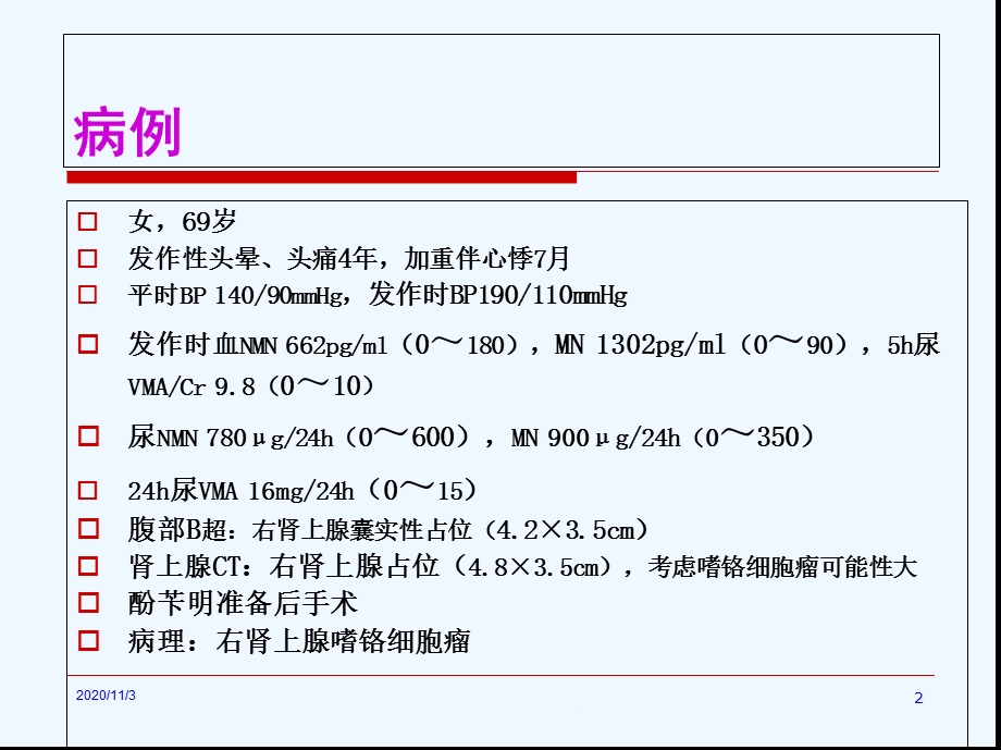 嗜铬细胞瘤的诊治课件.ppt_第2页