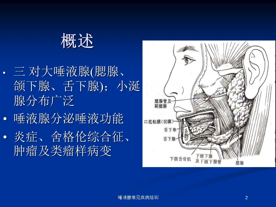 唾液腺常见疾病培训培训课件.ppt_第2页