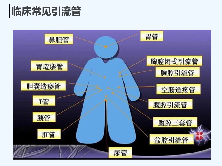 外科常见引流管的护理0PPT课件.ppt_第2页