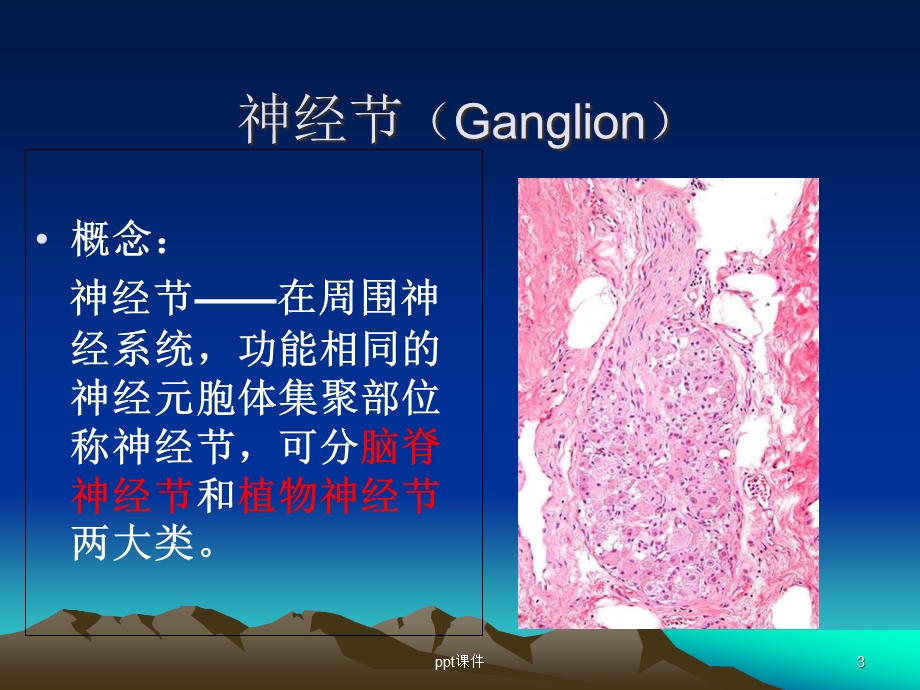 嗜铬细胞瘤(影像)课件.ppt_第3页