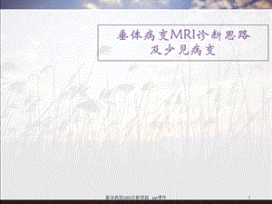 垂体病变MRI诊断思路课件.ppt