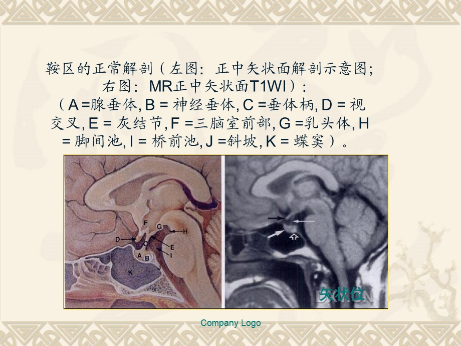 垂体的基础知识ppt课件.ppt_第3页