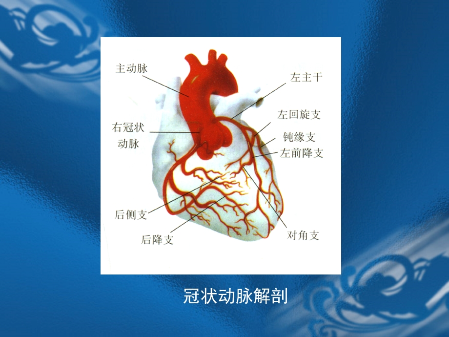 围手术期心肌缺血的诊断和治疗课件.ppt_第2页