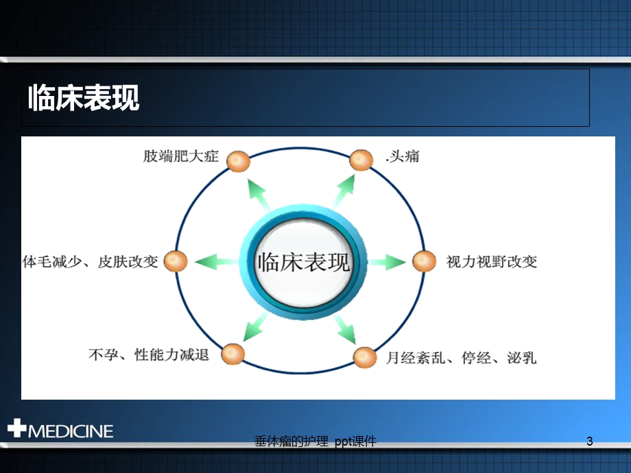 垂体瘤的护理课件.ppt_第3页