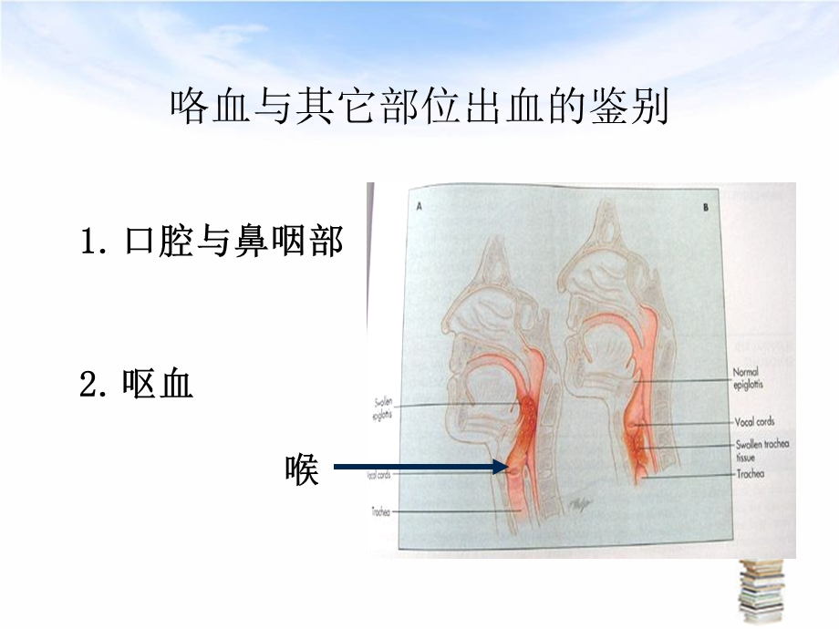 咯血的诊断与处理教学课件.pptx_第3页