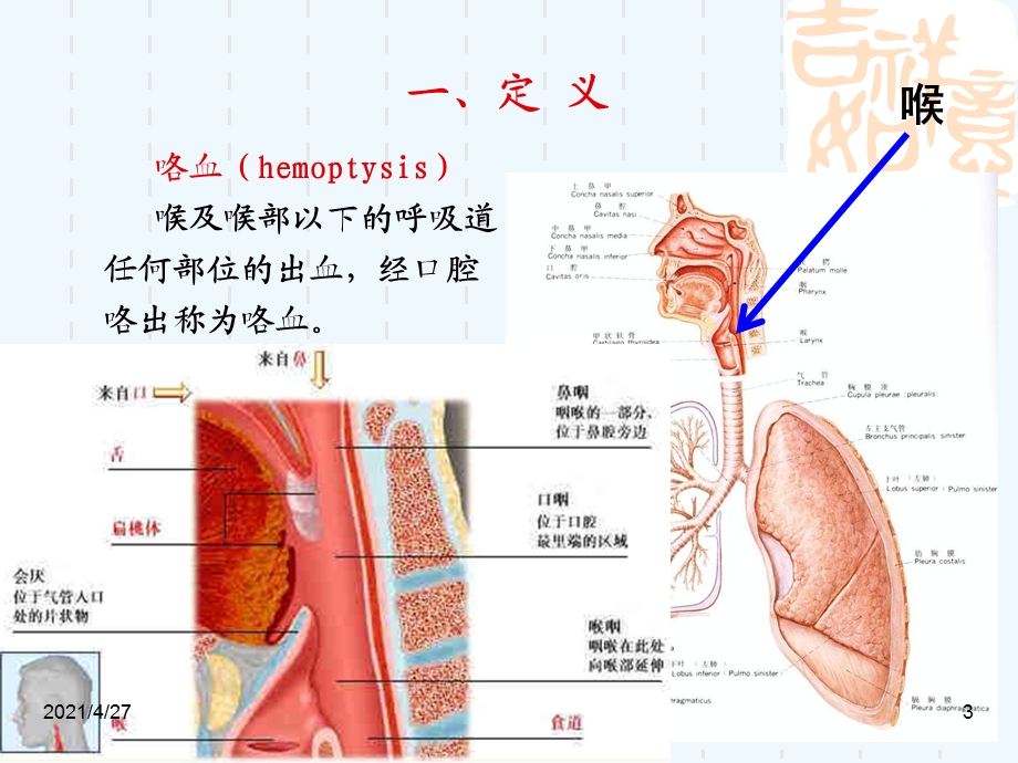 咯血教学课件.ppt_第3页