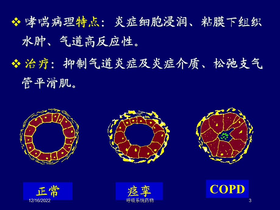 呼吸系统药物培训课件.ppt_第3页