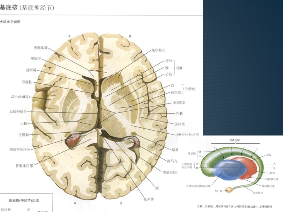 基底节区丘脑区对称性病变总结课件.ppt_第2页