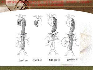 国人急性B型主动夹层治疗策略转变主动脉学习班培训课件.ppt