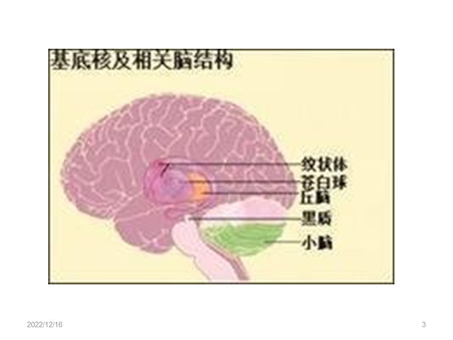 基底节区解剖位置关系图及临床优质课件.ppt_第3页