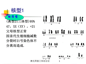 唐氏筛查三体综合征课件.ppt