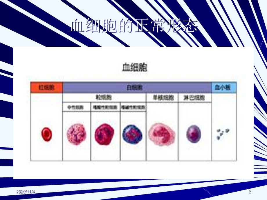 外周血细胞形态的临床应用课件.ppt_第3页