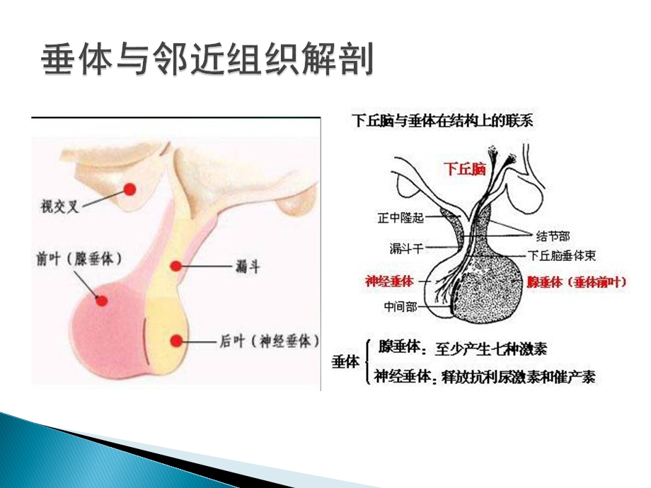 垂体瘤影像诊断ppt课件.pptx_第3页