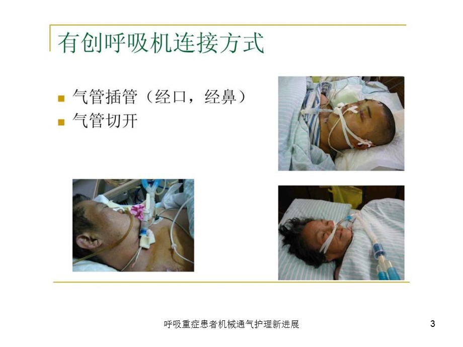 呼吸重症患者机械通气护理新进展课件.ppt_第3页