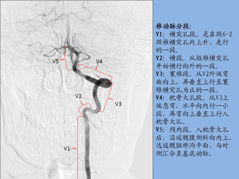 大脑动脉分段解剖图文ppt课件.pptx_第3页