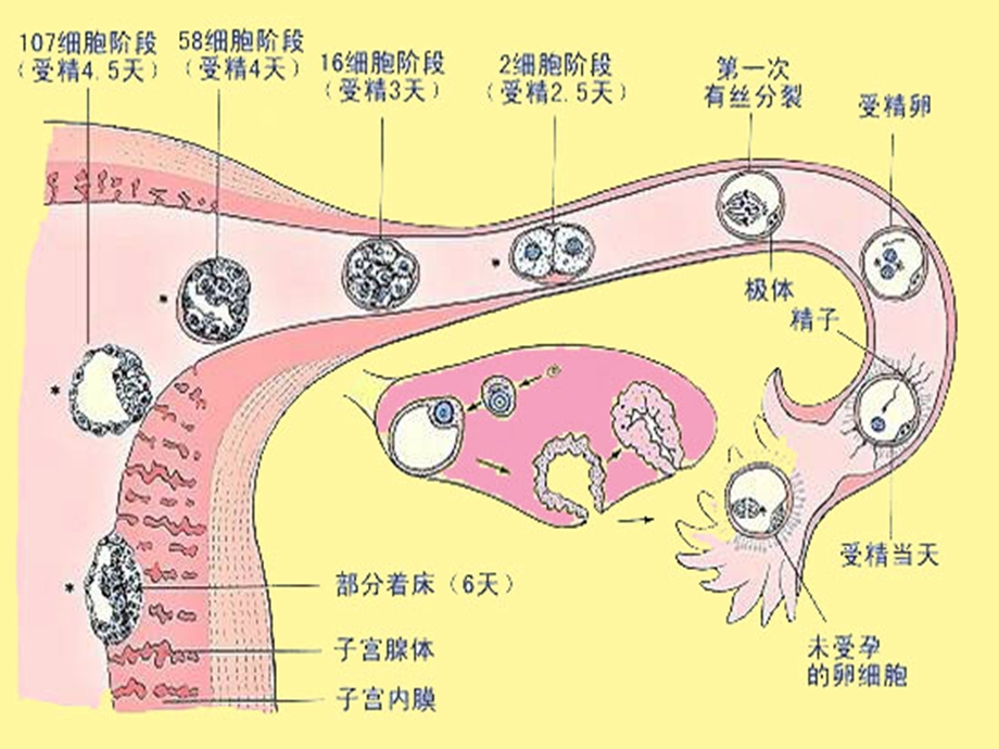 妊娠滋养细胞疾病病人的护理ppt课件.ppt_第2页