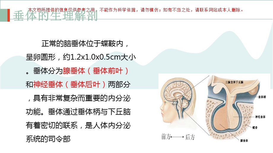 垂体瘤术后护理查房培训课件.ppt_第2页