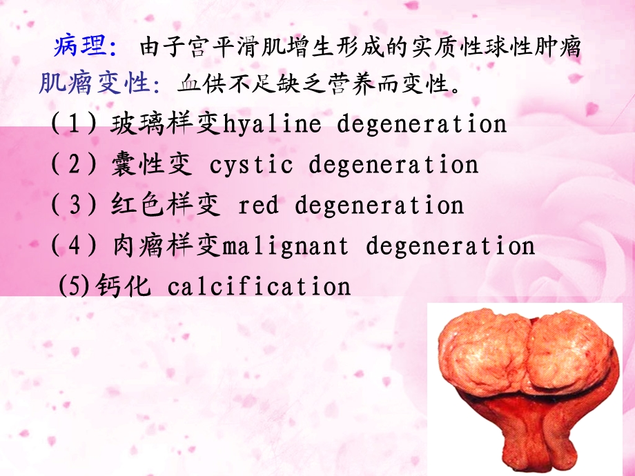 子宫颈癌PPT课件.ppt_第3页