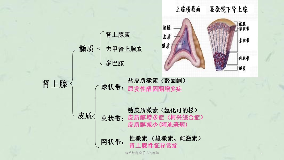 嗜铬细胞瘤手术的麻醉课件.ppt_第3页