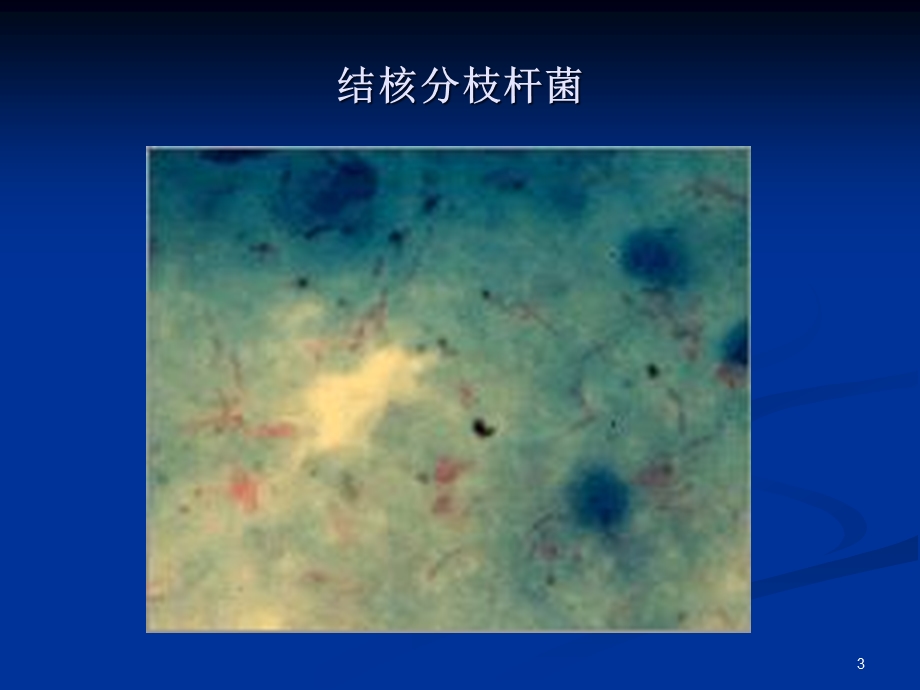 呼吸道感染细菌和厌氧菌课件.ppt_第3页