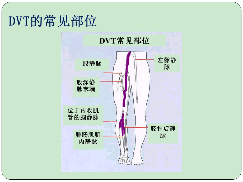 围手术期下肢深静脉血栓ppt课件.ppt_第3页