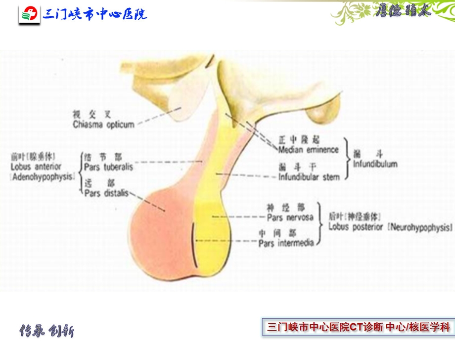 垂体解剖及垂体瘤ppt课件.ppt_第3页