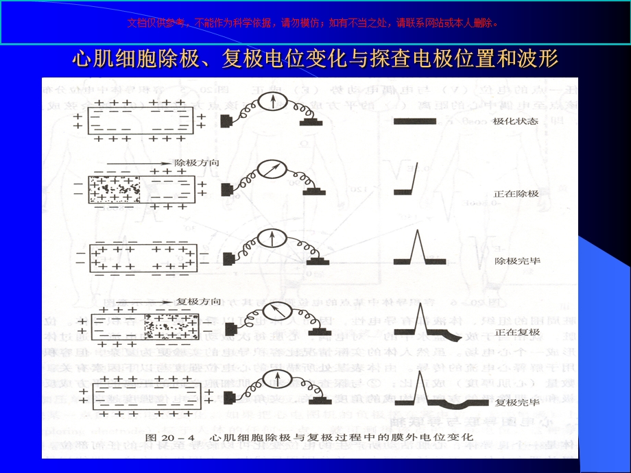 器械检查之心电图诊断培训课件.ppt_第3页