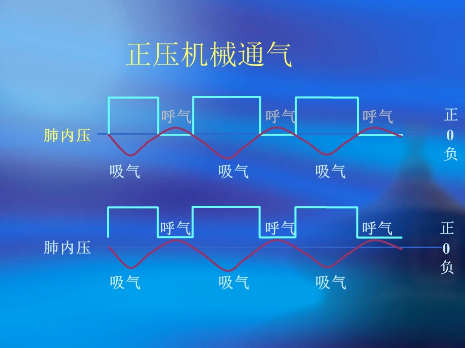 压控与容控课件.ppt_第2页