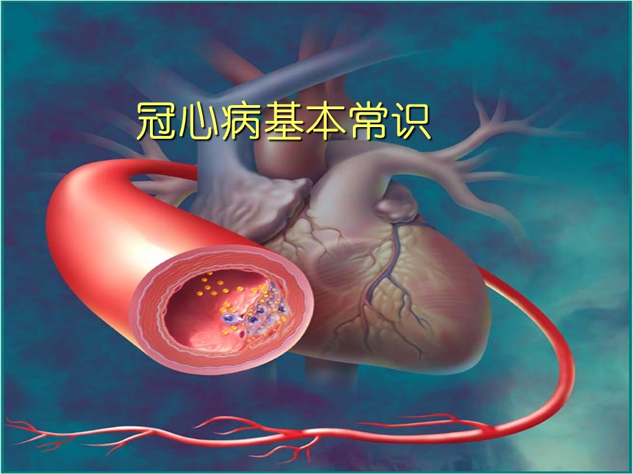 冠心病基本常识及病人的自我保健课件.ppt_第2页