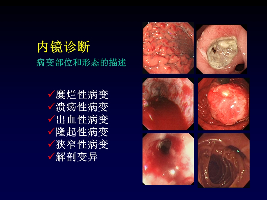 内镜诊断中的有关病理问题课件.ppt_第2页