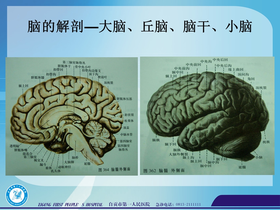 中枢神经系统影像课件.ppt_第3页