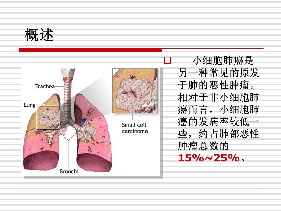 小细胞肺癌课件.ppt_第2页