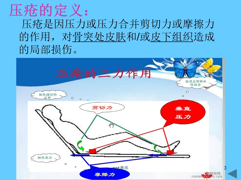 压疮的护理常规课件.ppt_第3页