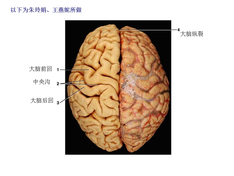 局部解剖标本考试课件.ppt_第1页